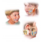 MOJO-TMJ-Gesundheitsschiene für Kinder